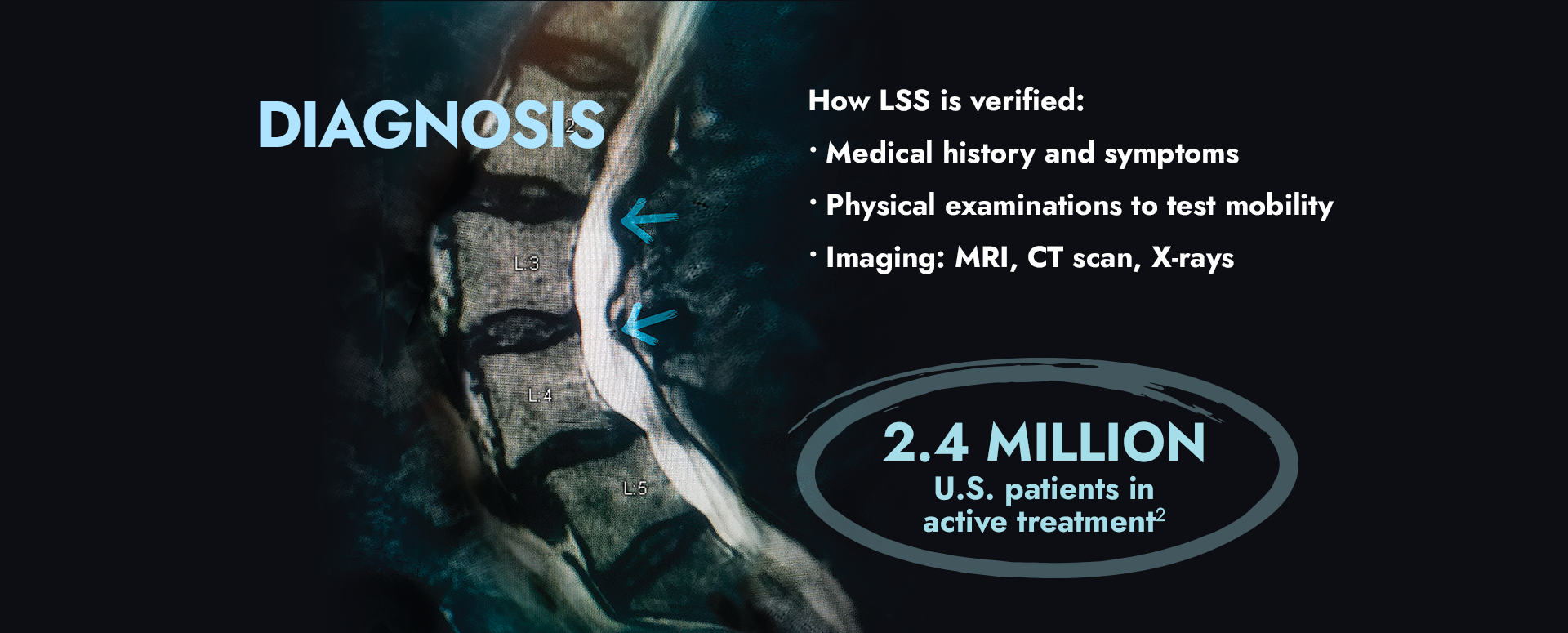 Diagnosis: How LSS is verified: Medical history and symptoms, physical examinations to test mobility, Imaging: MRI, CT scan, X-rays. 2.4 million U.S. patients in active treatment.